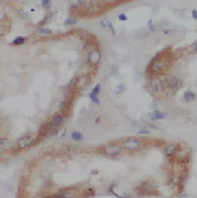 Immunohistochemistry: CYREN Antibody - BSA Free [NBP3-47742] - Immunohistochemistry of paraffin-embedded human kidney tissue slide using (CYREN Antibody) at dilution of 1:50