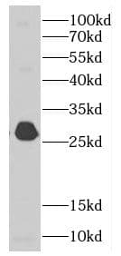Western Blot: MALSU1 Antibody - BSA Free [NBP3-47744] - HEK-293 cells were subjected to SDS PAGE followed by western blot with (MALSU1 antibody) at dilution of 1:1000