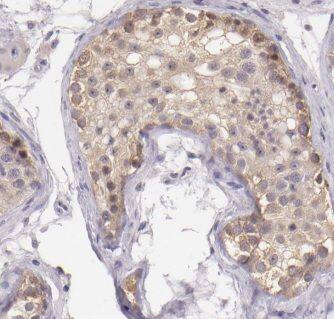 Immunohistochemistry: MALSU1 Antibody - BSA Free [NBP3-47744] - Immunohistochemistry of paraffin-embedded human testis using (MALSU1 antibody) at dilution of 1:50