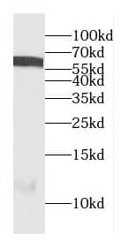 Western Blot CEP85L Antibody - BSA Free