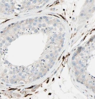 Immunohistochemistry CEP85L Antibody - BSA Free