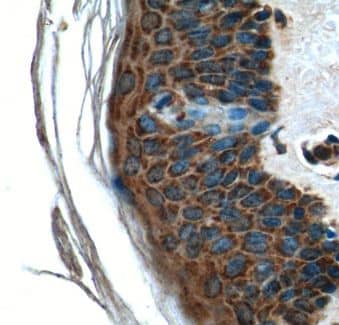 Immunohistochemistry: STG Antibody - BSA Free [NBP3-47750] - Immunohistochemistry of paraffin-embedded human skin tissue slide using (STG Antibody) at dilution of 1:50