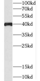 Western Blot: C5orf4 Antibody - BSA Free [NBP3-47753] - COLO 320 cells were subjected to SDS PAGE followed by western blot with (C5orf4 Antibody) at dilution of 1:300