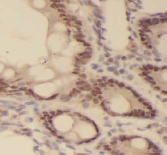 Immunohistochemistry: C5orf4 Antibody - BSA Free [NBP3-47753] - Immunohistochemistry of paraffin-embedded human kidney tissue slide using (C5orf4 Antibody) at dilution of 1:50