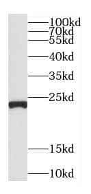 Western Blot: C5orf24 Antibody - BSA Free [NBP3-47754] - HEK-293 cells were subjected to SDS PAGE followed by western blot with (C5orf24 Antibody) at dilution of 1:1000