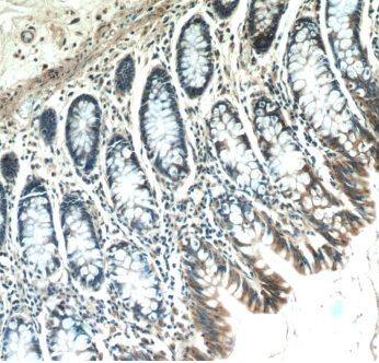 Immunohistochemistry: ABHD18 Antibody - BSA Free [NBP3-47756] - Immunohistochemistry of paraffin-embedded human colon tissue slide using (ABHD18 Antibody) at dilution of 1:50