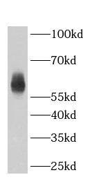Western Blot ABHD18 Antibody - BSA Free