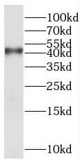 Western Blot XXYLT1 Antibody - BSA Free