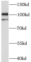 Western Blot: C3orf20 Antibody - BSA Free [NBP3-47761] - Human brain tissue were subjected to SDS PAGE followed by western blot with (C3orf20 antibody) at dilution of 1:500