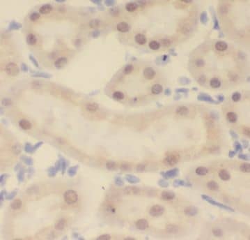 Immunohistochemistry: KANSL1L Antibody - BSA Free [NBP3-47763] - Immunohistochemistry of paraffin-embedded human kidney tissue slide using (KANSL1L Antibody) at dilution of 1:50