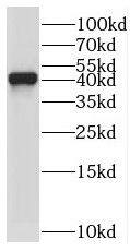 Western Blot: TYW5 Antibody - BSA Free [NBP3-47764] - Jurkat cells were subjected to SDS PAGE followed by western blot with ( TYW5 Antibody) at dilution of 1:600