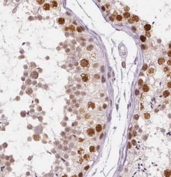 Immunohistochemistry SYCE3 Antibody - BSA Free