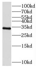 Western Blot: C21orf59 Antibody - BSA Free [NBP3-47767] - K-562 cells were subjected to SDS PAGE followed by western blot with ( C21orf59 Antibody) at dilution of 1:1000