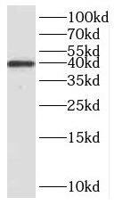 Western Blot: Replication Termination Factor 2 Antibody - BSA Free [NBP3-47771] - MCF-7 cells were subjected to SDS PAGE followed by western blot with (Replication Termination Factor 2 antibody) at dilution of 1:2000