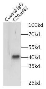 Immunoprecipitation: Replication Termination Factor 2 Antibody - BSA Free [NBP3-47771] - IP Result of anti-Replication Termination Factor 2 (IP:, 3ug; Detection: 1:500) with HeLa cells lysate 3440ug.
