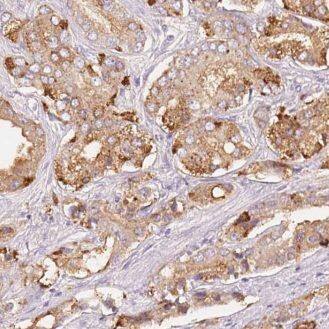 Immunohistochemistry FNDC11 Antibody - BSA Free