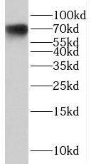 Western Blot CNBD2 Antibody - BSA Free
