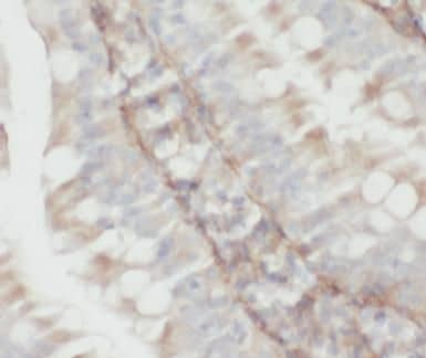 Immunohistochemistry: PPDPF Antibody - BSA Free [NBP3-47778] - Immunohistochemistry of paraffin-embedded human colon using (PPDPF antibody) at dilution of 1:100