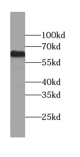 Western Blot: LRRC71 Antibody - BSA Free [NBP3-47781] - HeLa cells were subjected to SDS PAGE followed by western blot with ( LRRC71 Antibody) at dilution of 1:300