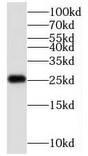 Western Blot C1orf50 Antibody - BSA Free