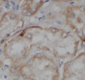 Immunohistochemistry C1orf50 Antibody - BSA Free