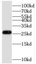 Western Blot SELRC1 Antibody - BSA Free