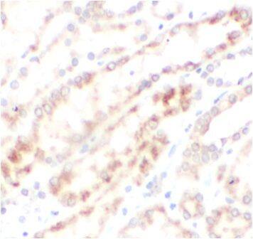 Immunohistochemistry: METTL18 Antibody - BSA Free [NBP3-47790] - Immunohistochemistry of paraffin-embedded human kidney using (METTL18 antibody) at dilution of 1:100