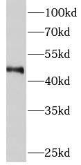 Western Blot: METTL18 Antibody - BSA Free [NBP3-47790] - Various lysates were subjected to SDS PAGE followed by western blot with ( METTL18 Antibody) at dilution of 1:500