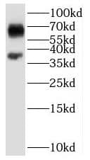Western Blot: SARG Antibody - BSA Free [NBP3-47791] - PC-3 cells were subjected to SDS PAGE followed by western blot with (SARG antibody) at dilution of 1:800