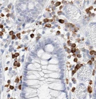 Immunohistochemistry: INAVA Antibody - BSA Free [NBP3-47792] - Immunohistochemistry of paraffin-embedded human colon using (INAVA antibody) at dilution of 1:50