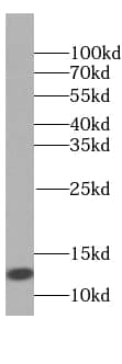 Western Blot QIL1 Antibody - BSA Free