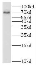 Western Blot: C19orf57 Antibody - BSA Free [NBP3-47795] - PC-3 cells were subjected to SDS PAGE followed by western blot with ( C19orf57 Antibody) at dilution of 1:1000