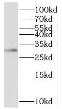 Western Blot: TIMM29 Antibody - BSA Free [NBP3-47796] - Mouse skeletal muscle tissue were subjected to SDS PAGE followed by western blot with ( TIMM29 Antibody) at dilution of 1:1000