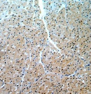 Immunohistochemistry: MGC2803 Antibody - BSA Free [NBP3-47798] - Immunohistochemistry of paraffin-embedded human heart using (MGC2803 antibody) at dilution of 1:50