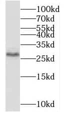 Western Blot: MGC2803 Antibody - BSA Free [NBP3-47798] - A431 cells were subjected to SDS PAGE followed by western blot with (MGC2803 antibody) at dilution of 1:300