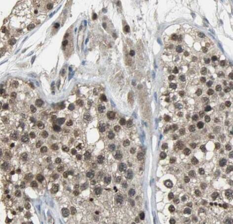 Immunohistochemistry: IZUMO4 Antibody - BSA Free [NBP3-47799] - Immunohistochemistry of paraffin-embedded mouse testis tissue slide using (IZUMO4 Antibody) at dilution of 1:50