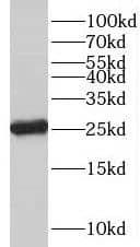 Western Blot: C18orf21 Antibody - BSA Free [NBP3-47804] - COLO 320 cells were subjected to SDS PAGE followed by western blot with (C18orf21 Antibody) at dilution of 1:600