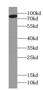 Western Blot: HID1 Antibody - BSA Free [NBP3-47807] - Fetal human brain tissue were subjected to SDS PAGE followed by western blot with ( HID1 Antibody) at dilution of 1:1000