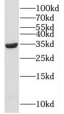 Western Blot: CCDC189 Antibody - BSA Free [NBP3-47808] - Raji cells were subjected to SDS PAGE followed by western blot with (CCDC189 antibody) at dilution of 1:300