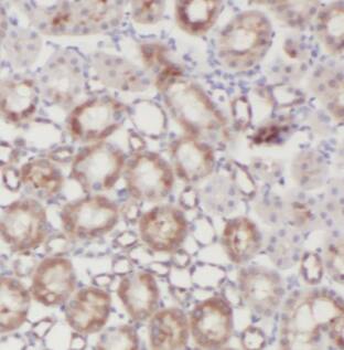 Immunohistochemistry: CTU2 Antibody - BSA Free [NBP3-47809] - Immunohistochemistry of paraffin-embedded human kidney tissue slide using (CTU2 Antibody) at dilution of 1:50