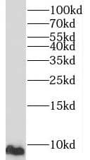 Western Blot: CMC2 Antibody - BSA Free [NBP3-47812] - PC-3 cells were subjected to SDS PAGE followed by western blot with (CMC2 Antibody) at dilution of 1:600