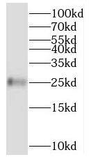 Western Blot: BMERB1 Antibody - BSA Free [NBP3-47813] - Mouse brain tissue were subjected to SDS PAGE followed by western blot with ( BMERB1 Antibody) at dilution of 1:600