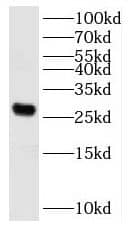 Western Blot KATNBL1 Antibody - BSA Free