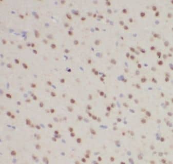 Immunohistochemistry KATNBL1 Antibody - BSA Free