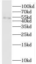 Western Blot: C14orf39 Antibody - BSA Free [NBP3-47819] - Jurkat cells were subjected to SDS PAGE followed by western blot with (C14orf39 antibody) at dilution of 1:1000