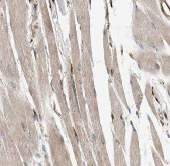 Immunohistochemistry: C14orf39 Antibody - BSA Free [NBP3-47819] - Immunohistochemistry of paraffin-embedded human skeletal muscle slide using (C14orf39 Antibody) at dilution of 1:50