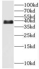 Western Blot: C14orf28 Antibody - BSA Free [NBP3-47820] - HeLa cells were subjected to SDS PAGE followed by western blot with (C14orf28 Antibody) at dilution of 1:300
