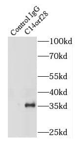 Immunoprecipitation: C14orf28 Antibody - BSA Free [NBP3-47820] - IP Result of anti-C14orf28 (IP:, 4ug; Detection: 1:300) with HeLa cells lysate 1200ug.