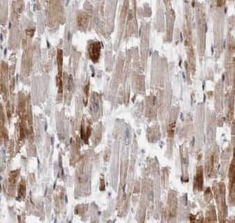 Immunohistochemistry: DGLUCY Antibody - BSA Free [NBP3-47823] - Immunohistochemistry of paraffin-embedded human heart tissue slide using (DGLUCY antibody) at dilution of 1:50