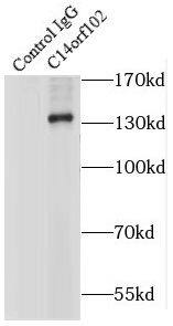 Immunoprecipitation: NRDE2 Antibody - BSA Free [NBP3-47825] - IP Result of anti-NRDE2 (IP:, 5ug; Detection: 1:500) with MCF-7 cells lysate 1200ug.
